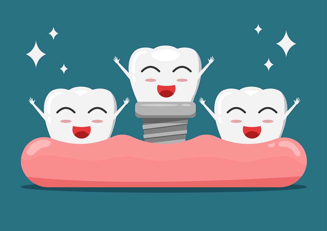 Dental Implants Manchester