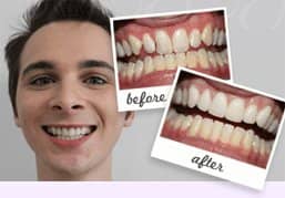 Smile gallery - Cheadle Hulme - Church Road Dental and Cosmetics