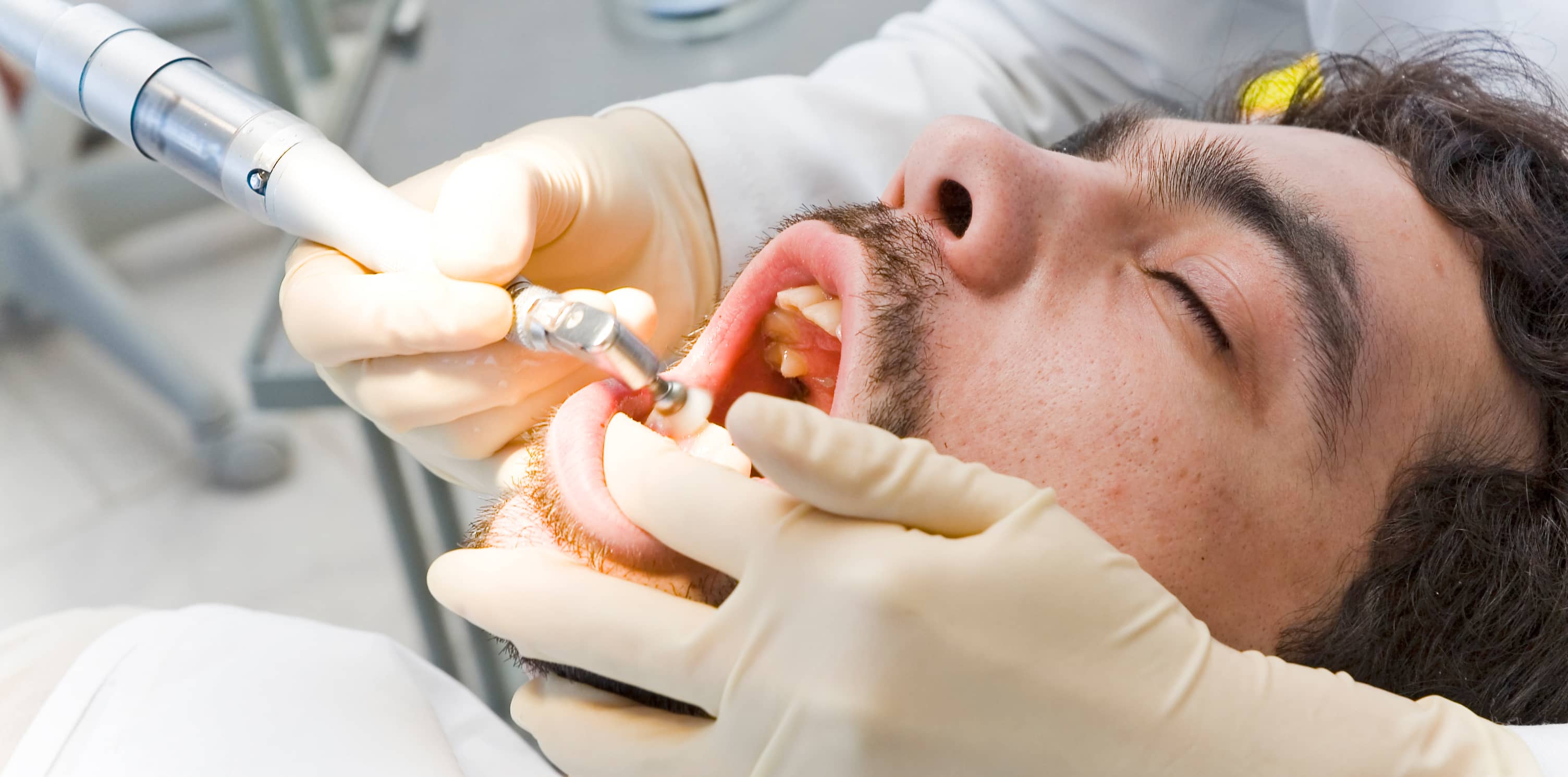 Стоматологический наркоз. Общая анестезия в стоматологии.