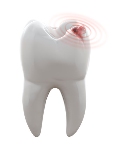 When To Seek An Emergency Dentist Cheadle Hulme