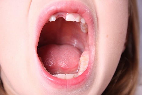 teeth, health, smile, dentist