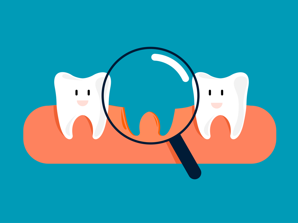 Dental Implants In Manchester