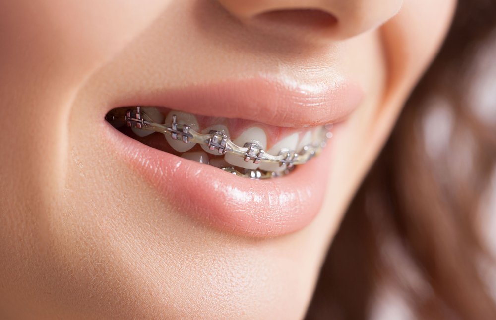 Dental Implants Manchester