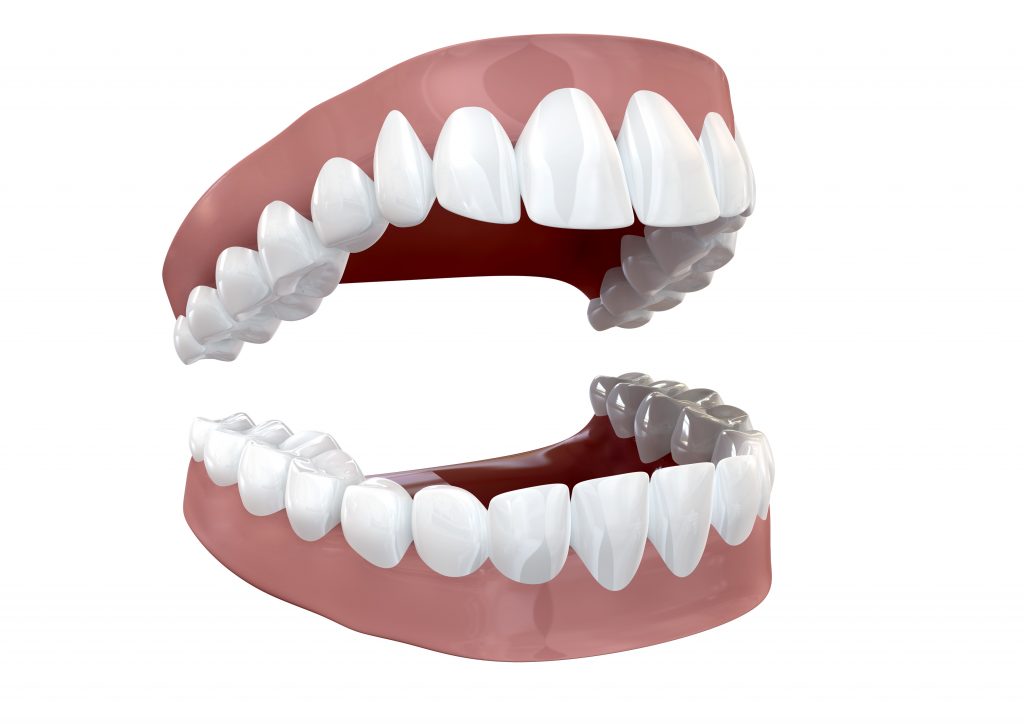 The Different Classes of Teeth Cheadle Dental Blog » Cheadle Dental Blog
