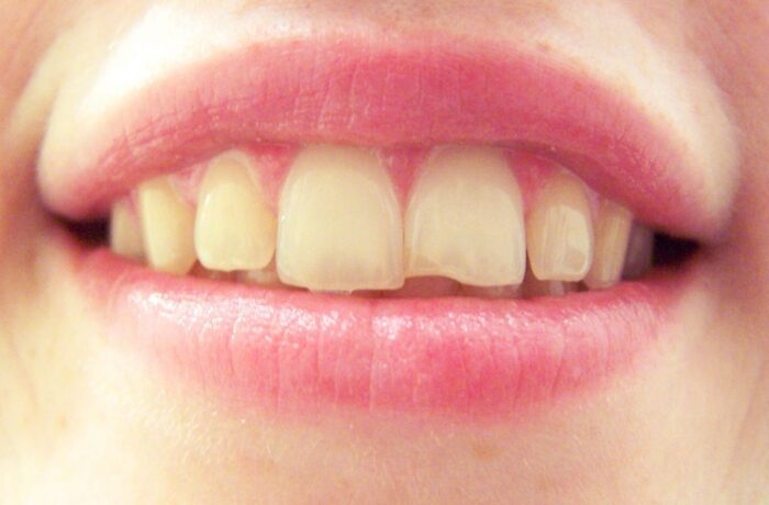 After - Cheadle Hulme Dental