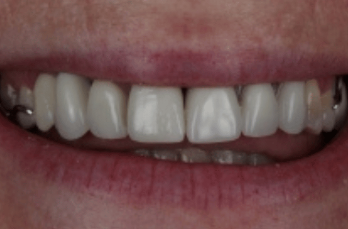 After - Cheadle Hulme Dental