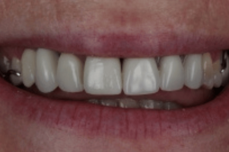 After - Cheadle Hulme Dental