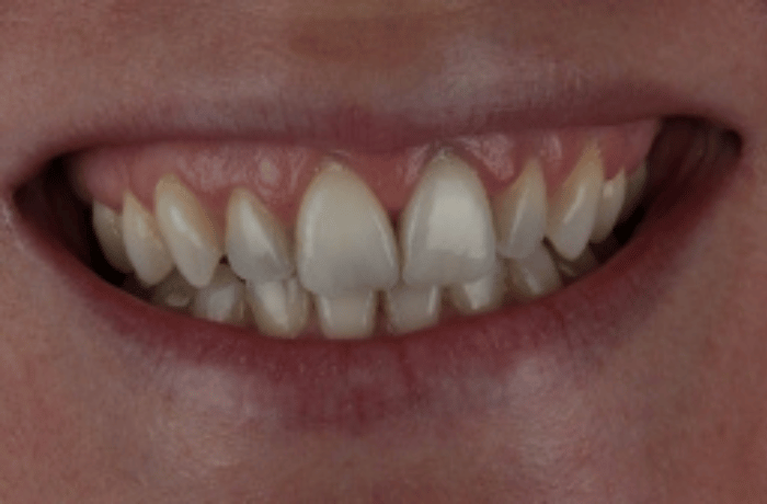 After - Cheadle Hulme Dental