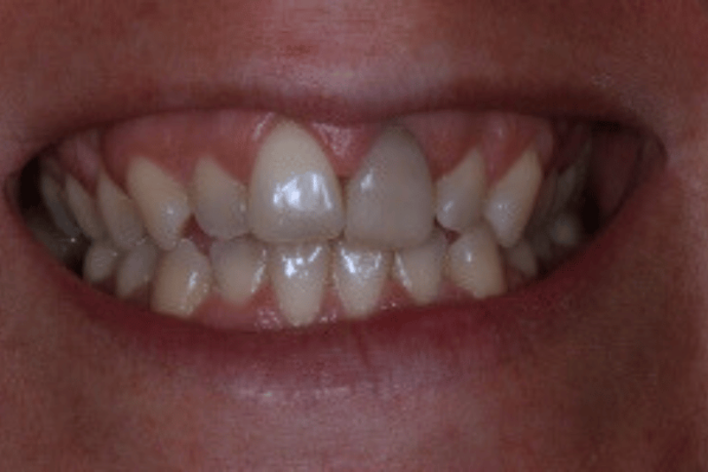 Before - Cheadle Hulme Dental