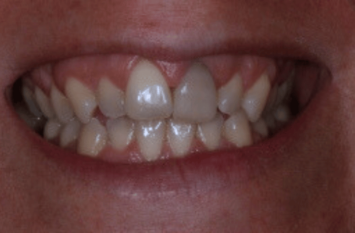 Before - Cheadle Hulme Dental