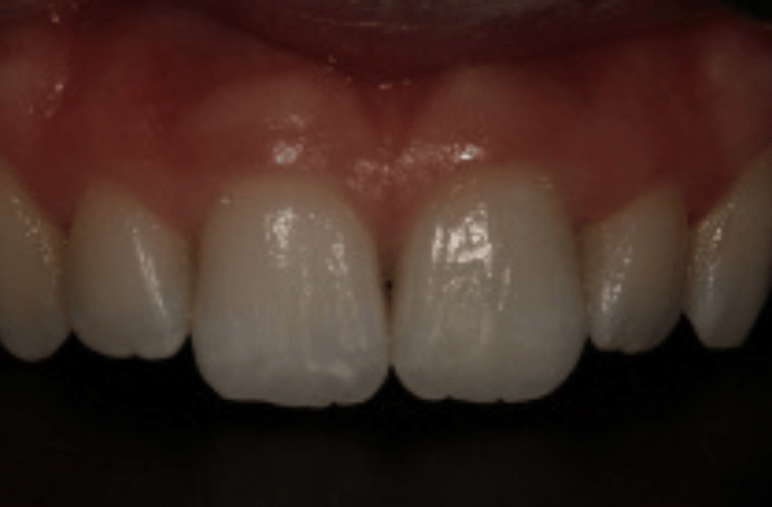 After - Cheadle Hulme Dental