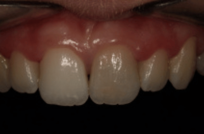 Before - Cheadle Hulme Dental