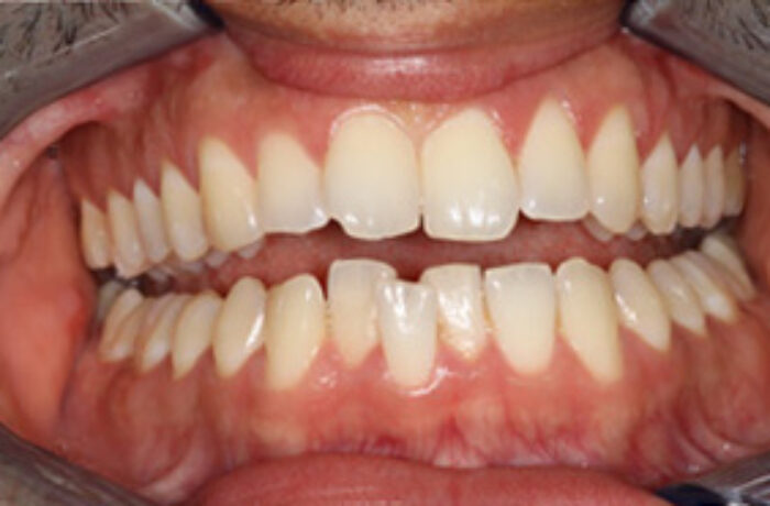 Before - Cheadle Hulme Dental