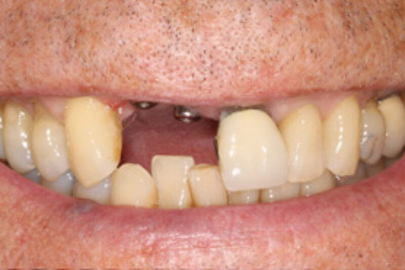 Before - Cheadle Hulme Dental