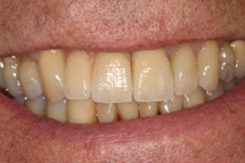 After - Cheadle Hulme Dental