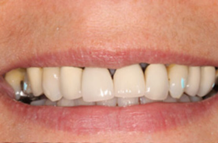 Before - Cheadle Hulme Dental