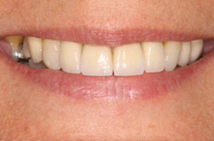 After - Cheadle Hulme Dental