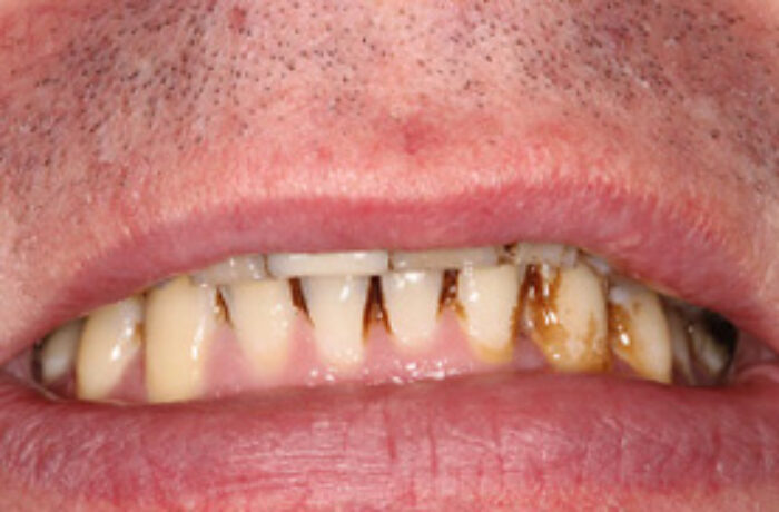 Before - Cheadle Hulme Dental