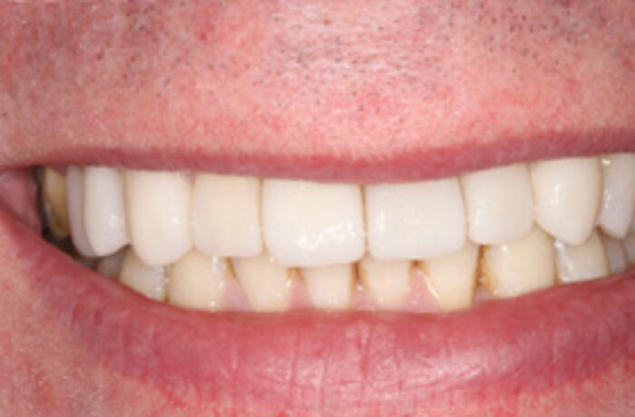After - Cheadle Hulme Dental