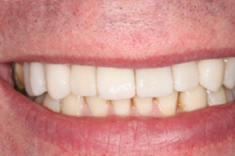 After - Cheadle Hulme Dental