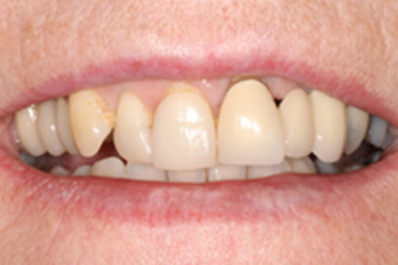 Before - Cheadle Hulme Dental