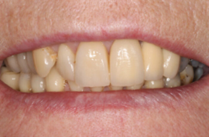 After - Cheadle Hulme Dental