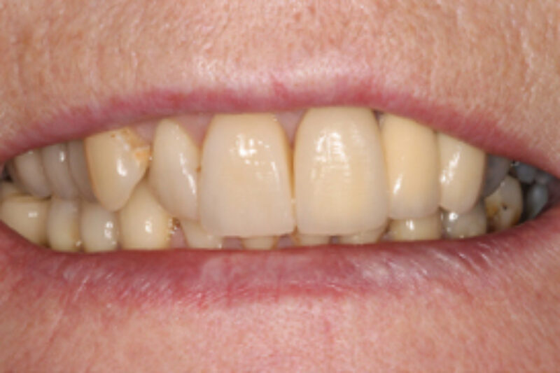 After - Cheadle Hulme Dental