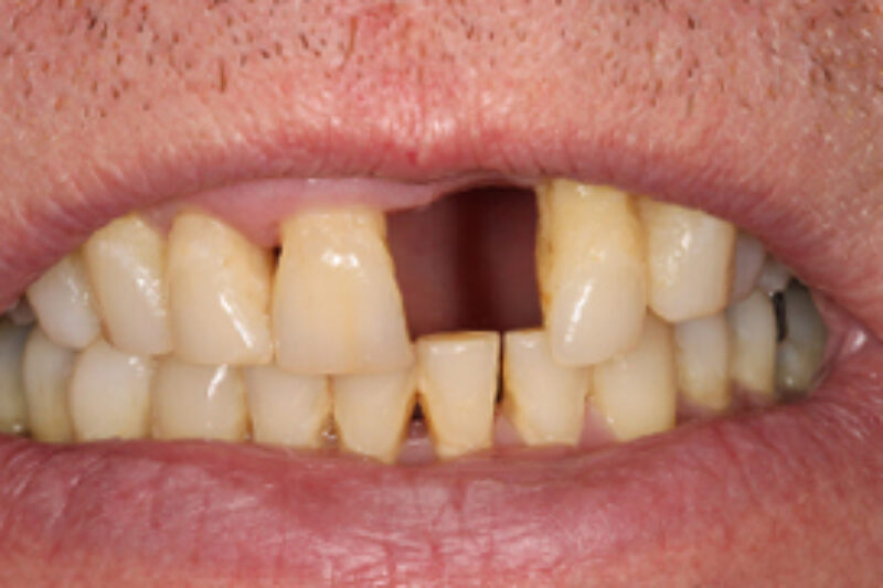 Before - Cheadle Hulme Dental