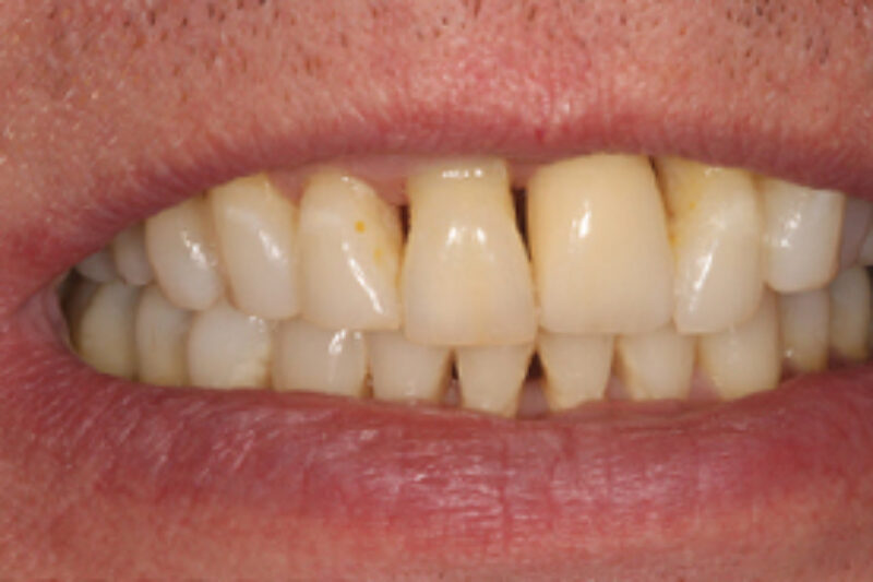 After - Cheadle Hulme Dental
