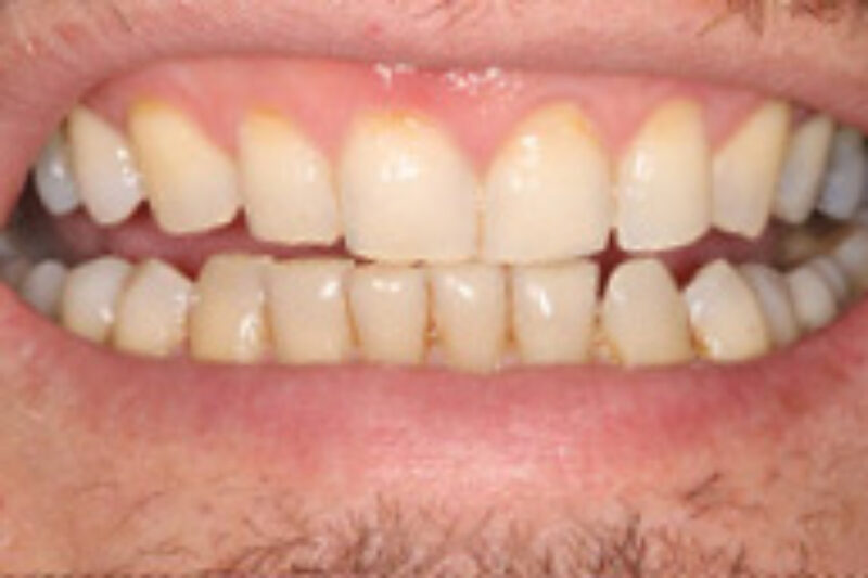 After - Cheadle Hulme Dental