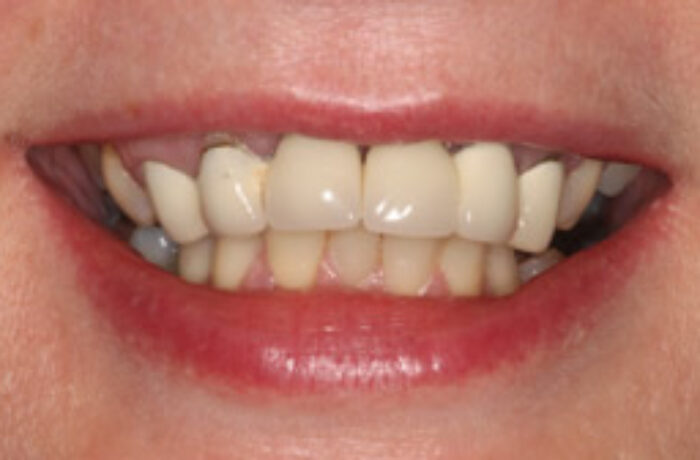 Before - Cheadle Hulme Dental