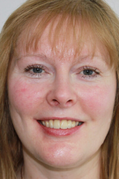 Cheadle Hulme Dental