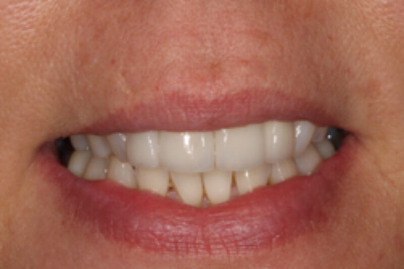 After - Cheadle Hulme Dental