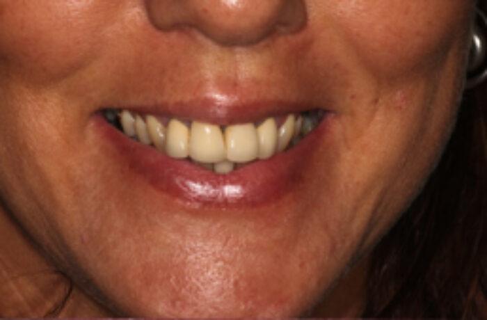 Before - Cheadle Hulme Dental