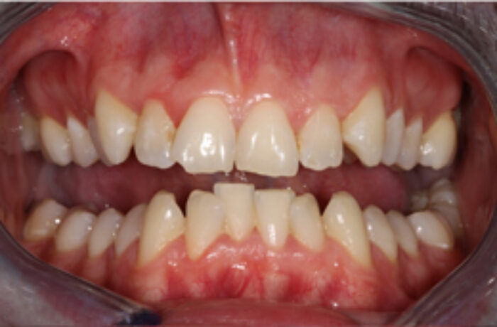 Before - Cheadle Hulme Dental
