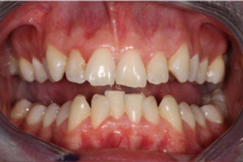 Before - Cheadle Hulme Dental