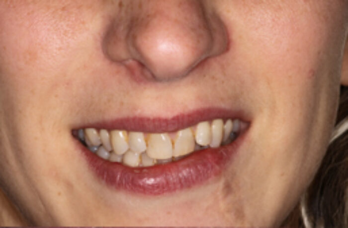 Before - Cheadle Hulme Dental