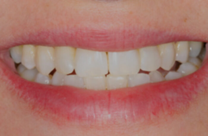 After - Cheadle Hulme Dental