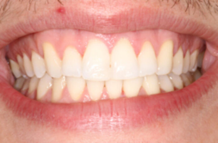 After - Cheadle Hulme Dental