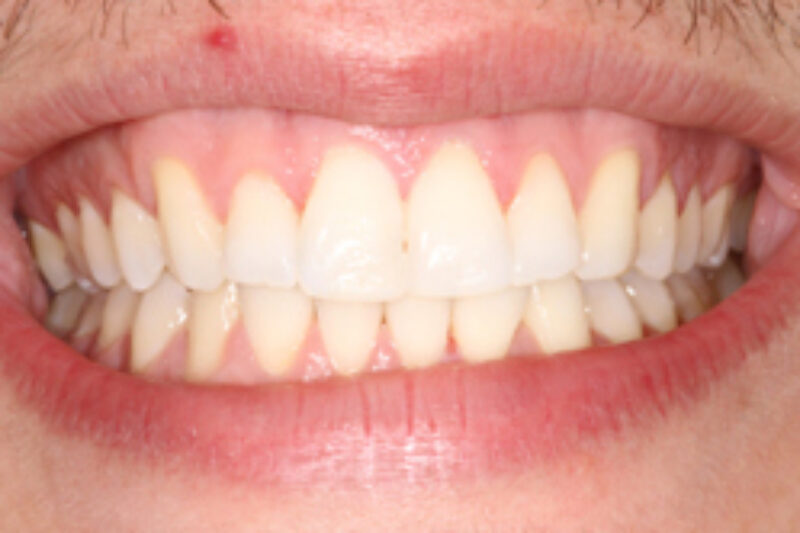 After - Cheadle Hulme Dental
