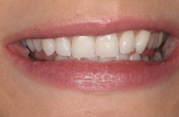 After - Cheadle Hulme Dental