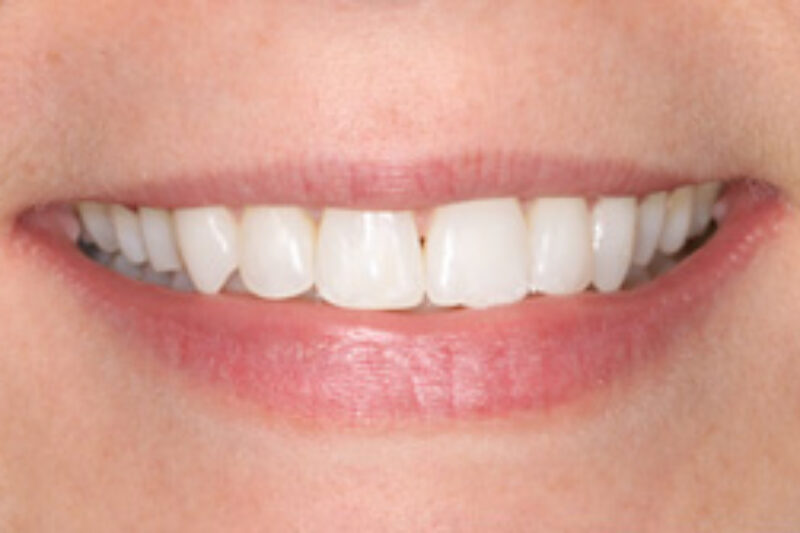  Cheadle Hulme Dental