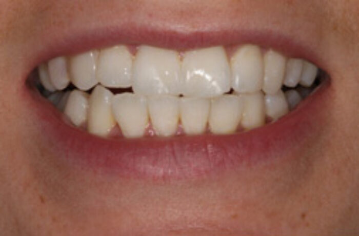 After - Cheadle Hulme Dental