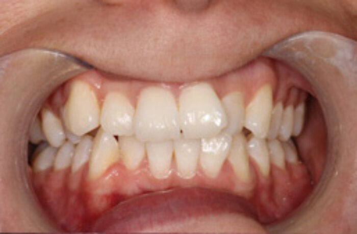 Before - Cheadle Hulme Dental