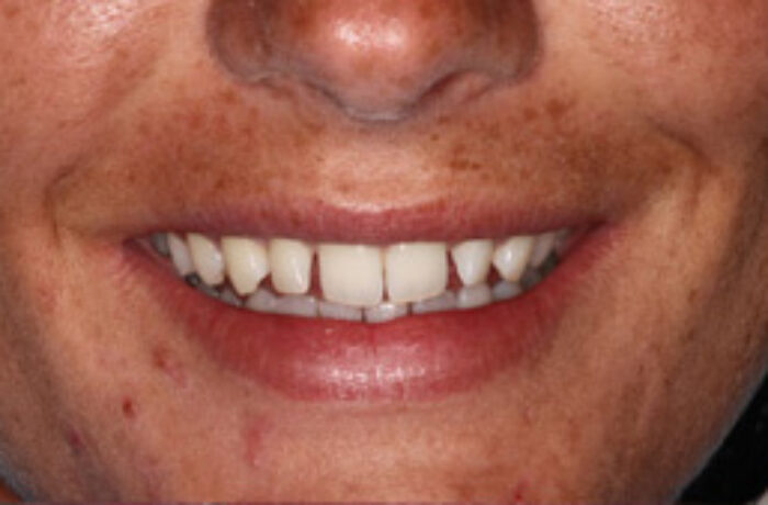 Before - Cheadle Hulme Dental