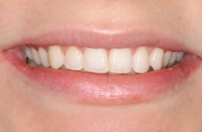 After - Cheadle Hulme Dental