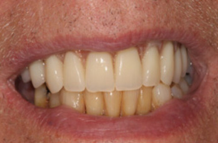 After - Cheadle Hulme Dental