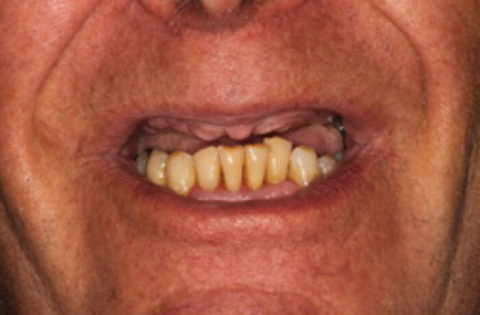 Before - Cheadle Hulme Dental