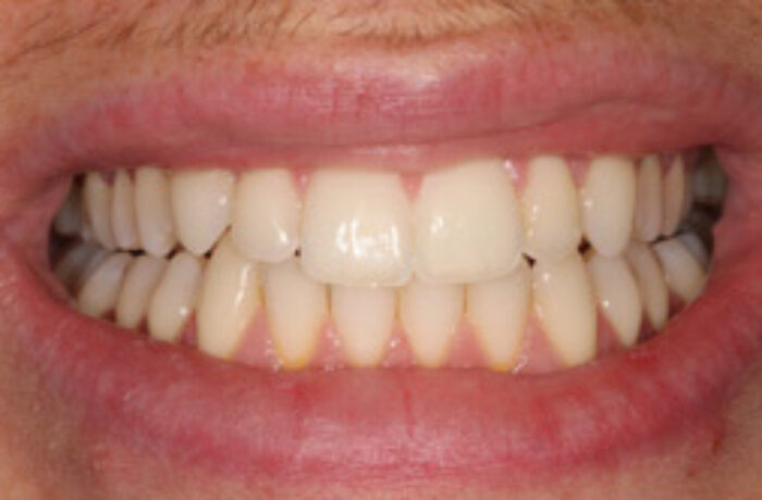 After - Cheadle Hulme Dental