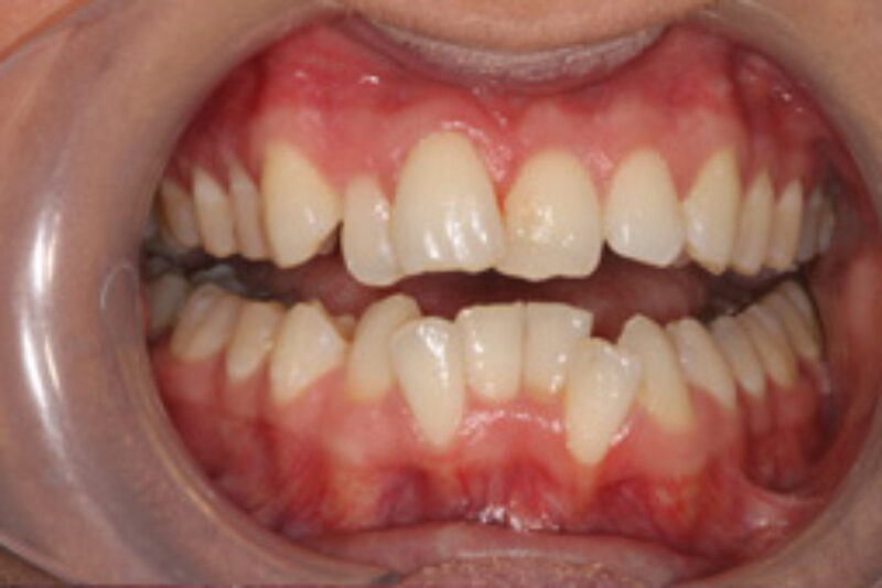 Before - Cheadle Hulme Dental